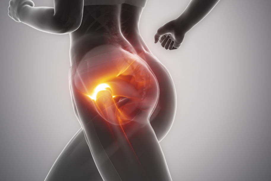 Hip Pain Isn’t Always the Hip: A Chiropractor in NYC Explains Pelvic Imbalances
